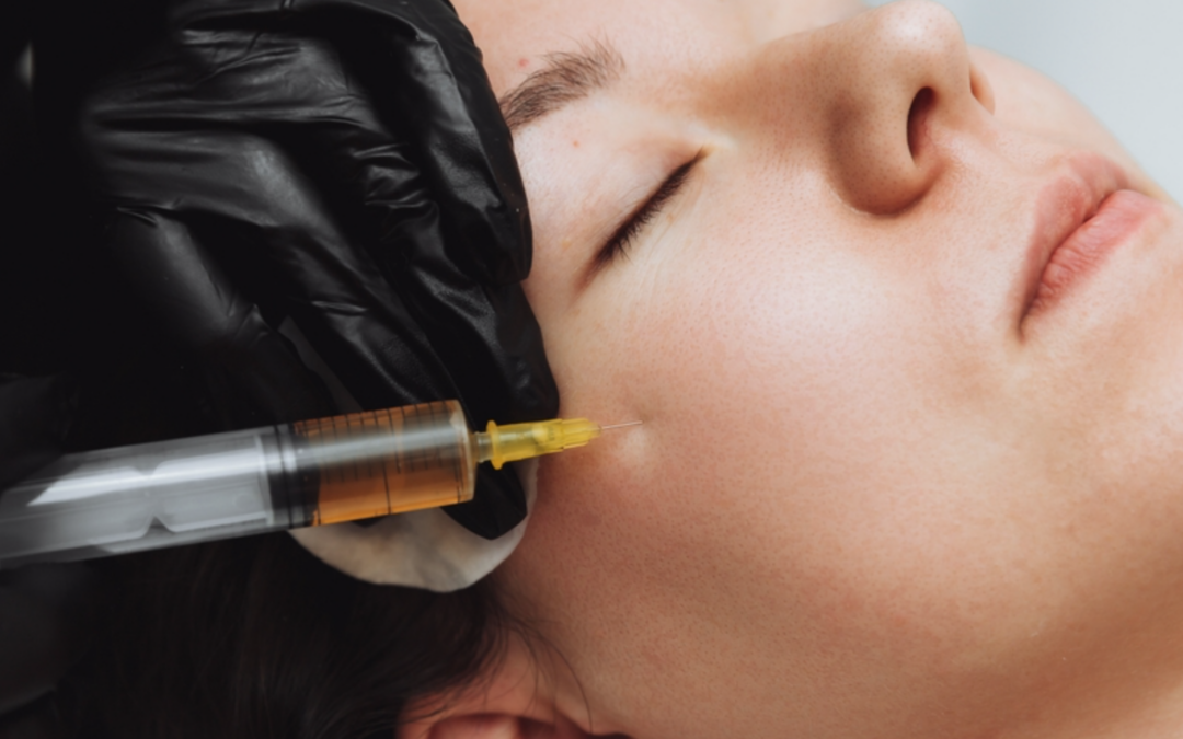 Medicina Estética – APLICAÇÕES DO PRP