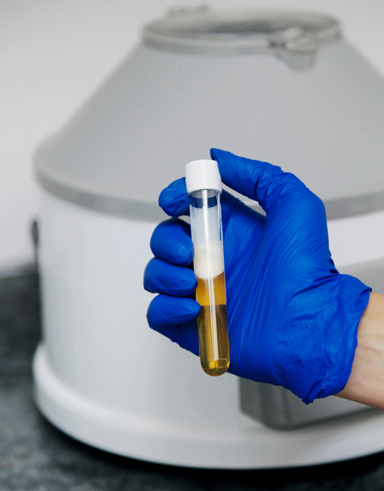 Doctor,In,Blue,Gloves,Keep,In,Hands,Test,Tube,With