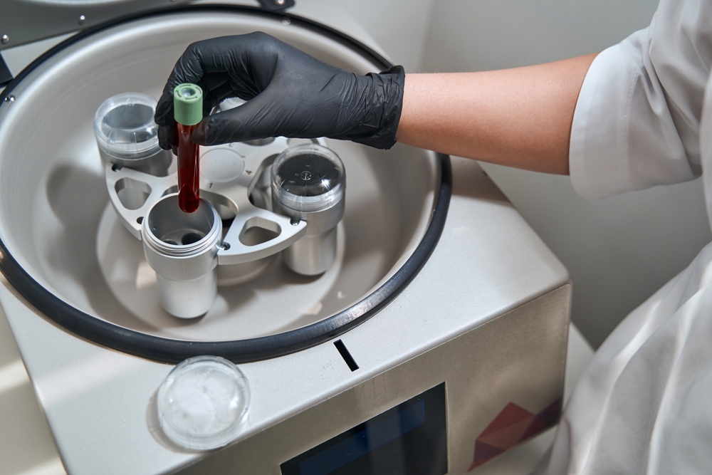Experienced,Doctor,Preparing,A,Platelet-rich,Plasma,For,Anti-aging,Therapy